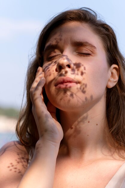 Dark Spots