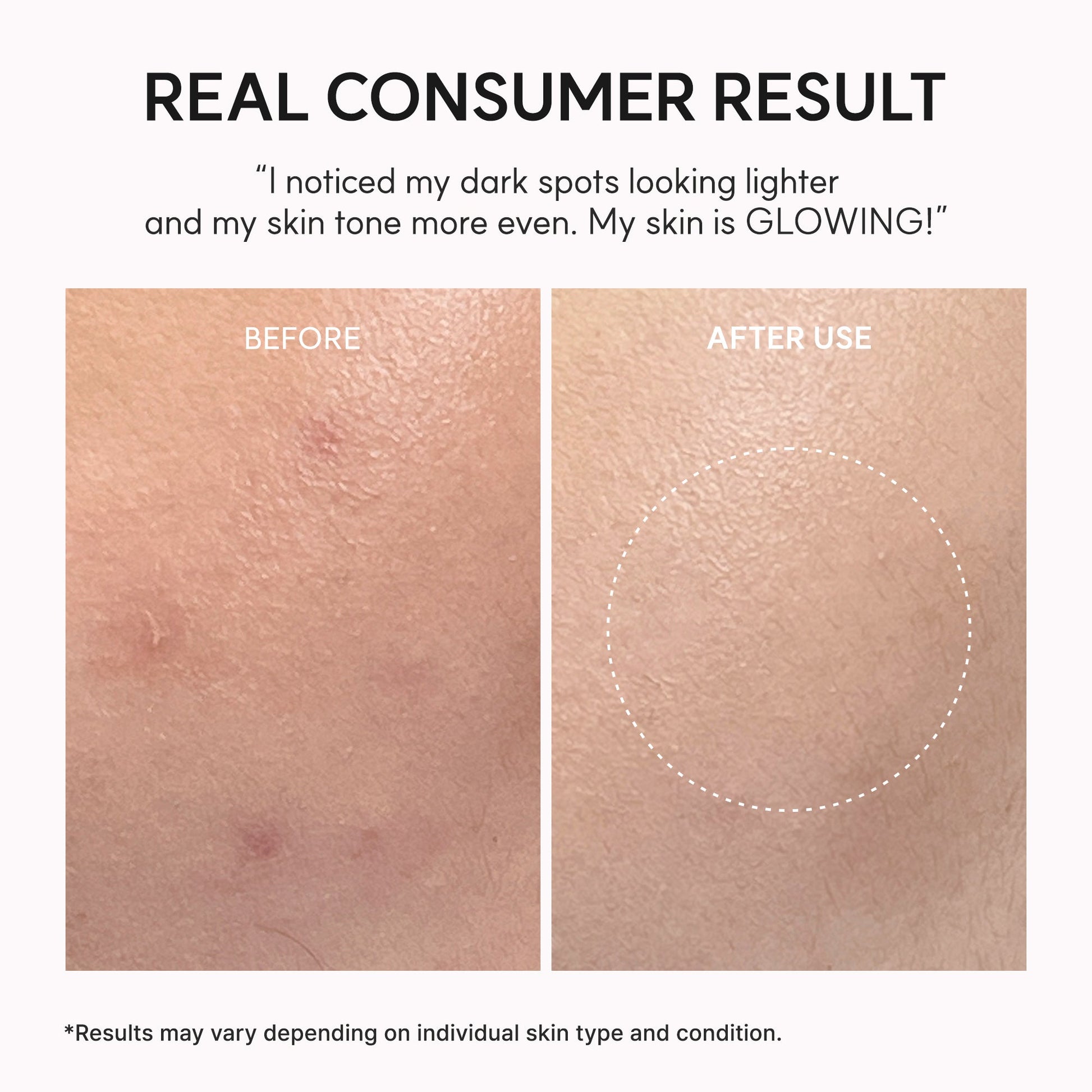 Arencia - TXA Booster Shot, Intensive Dark Spot Correcting Serum (30ml)-thekimyoung.com