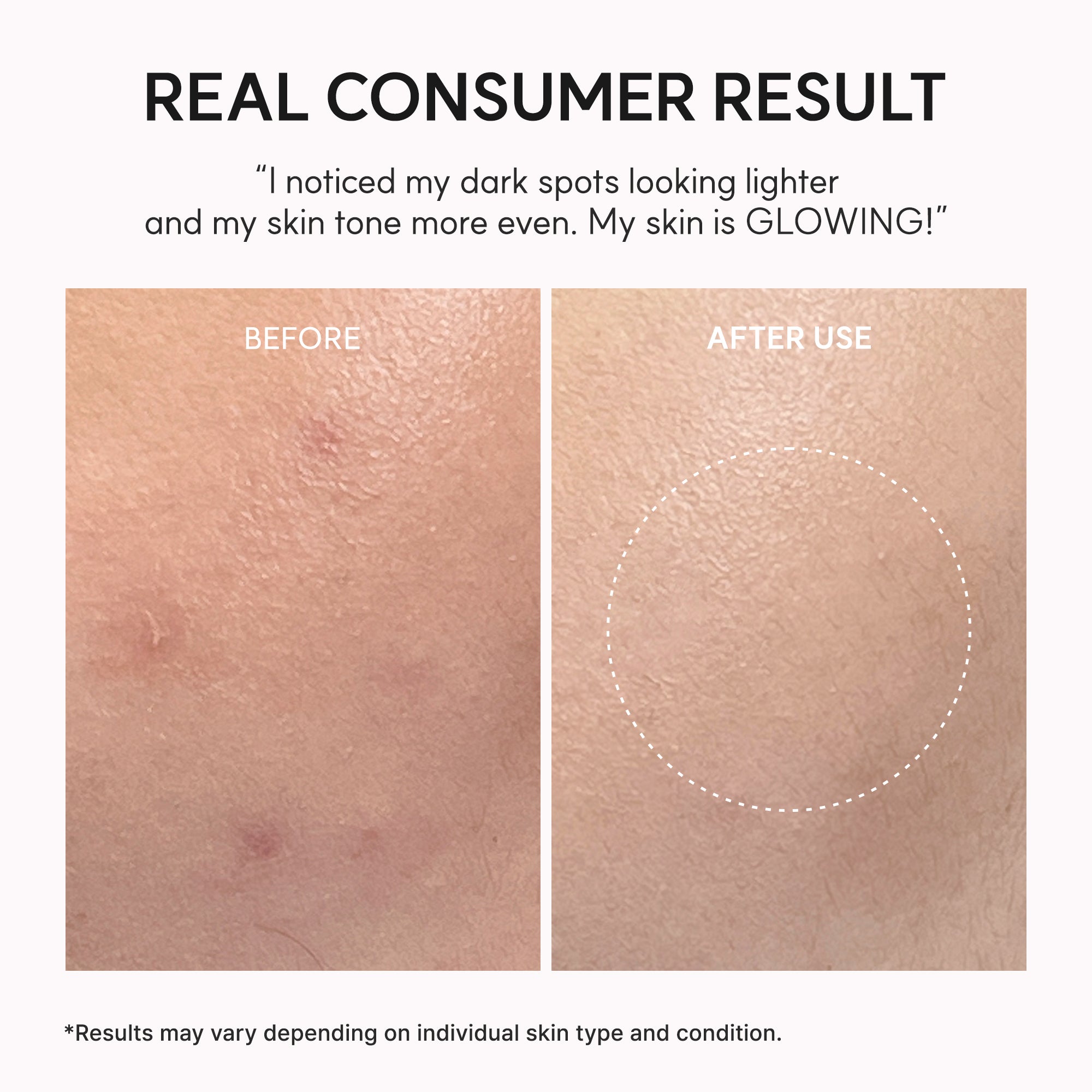 Arencia - TXA Booster Shot, Intensive Dark Spot Correcting Serum (30ml)-thekimyoung.com