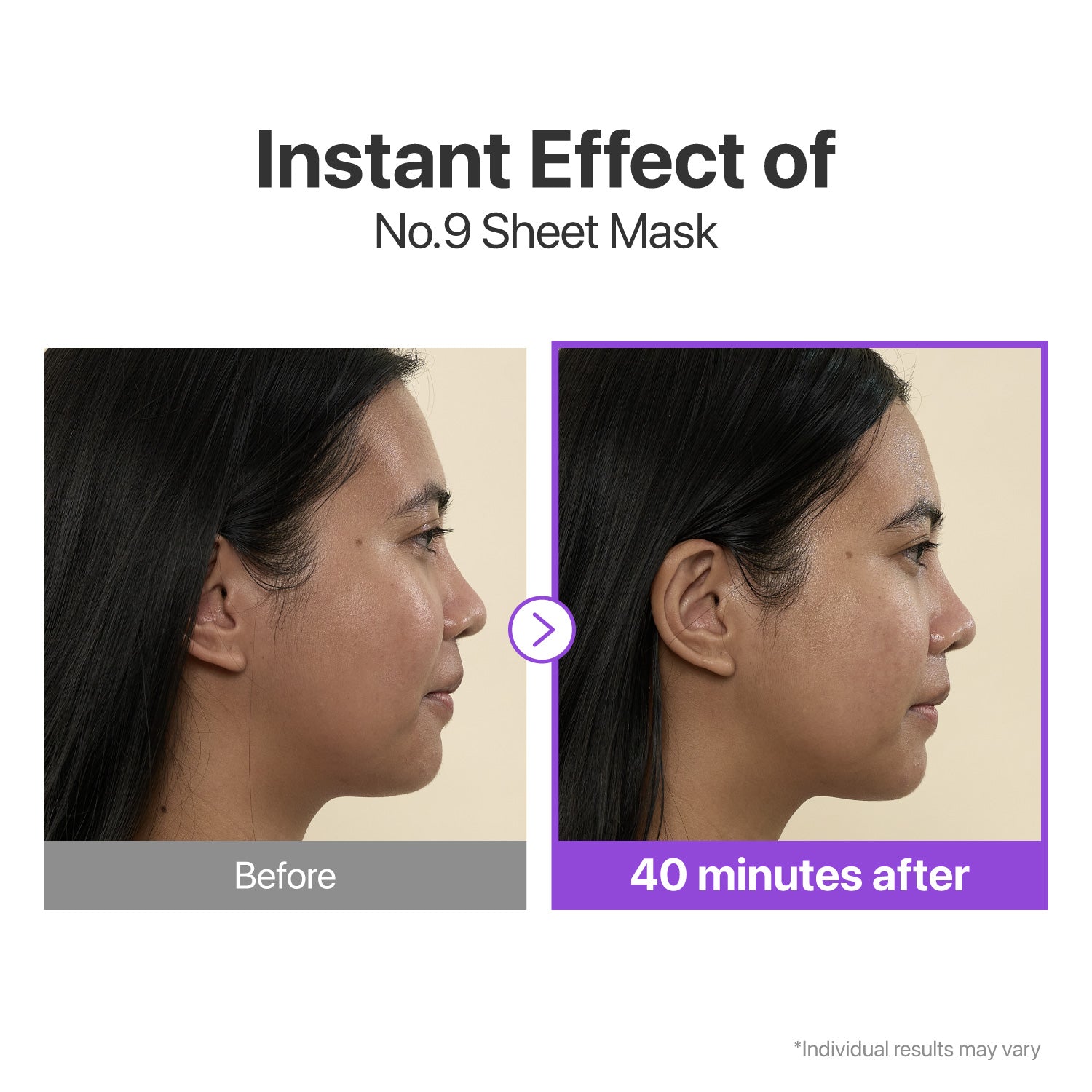 numbuzin - No.9 NAD Bio Lifting-sil Full Face Mask (4 Sheets + Lifting Band)-thekimyoung.com