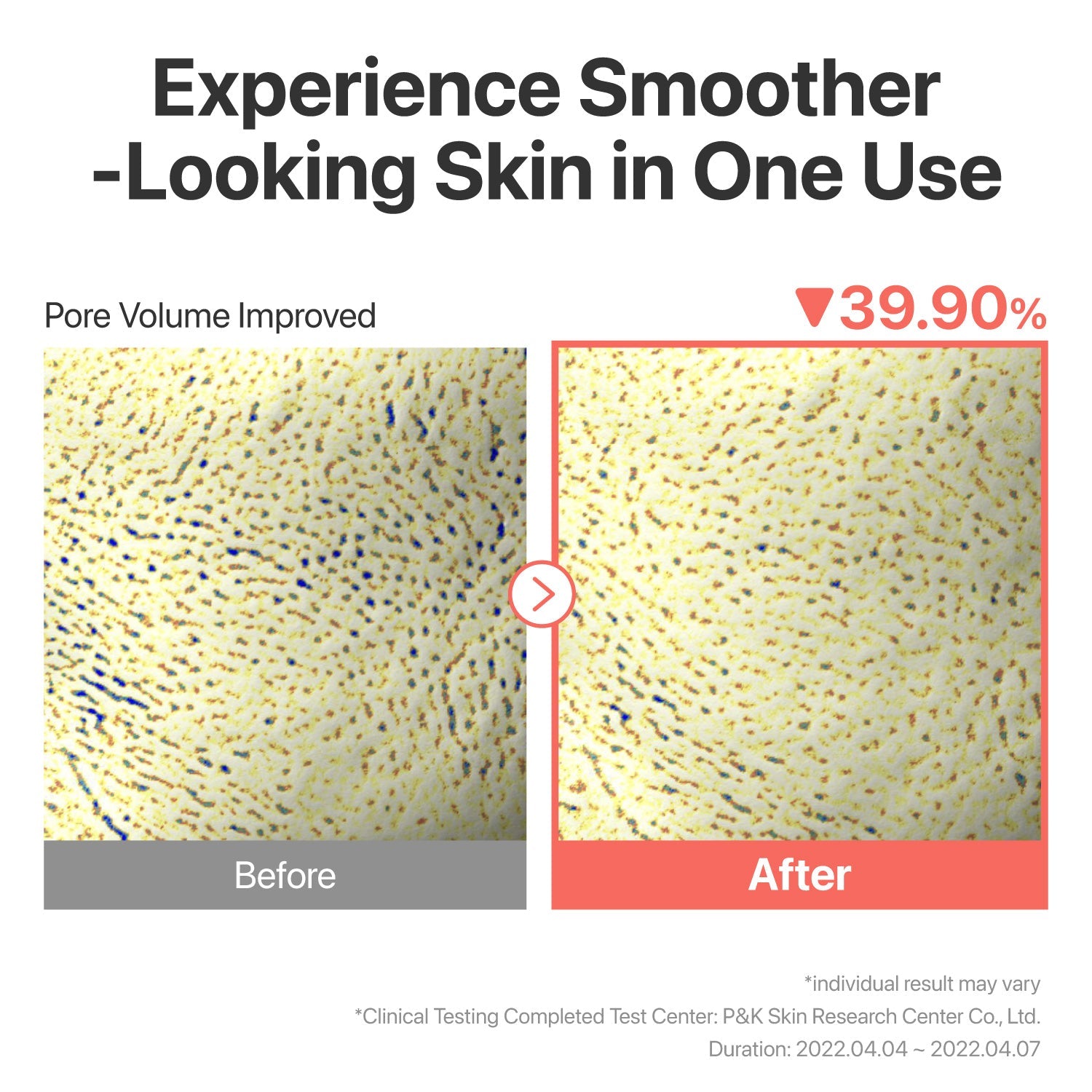numbuzin - No.3 Tingle-Pore Softening Sheet Mask (5 Sheets)-thekimyoung.com