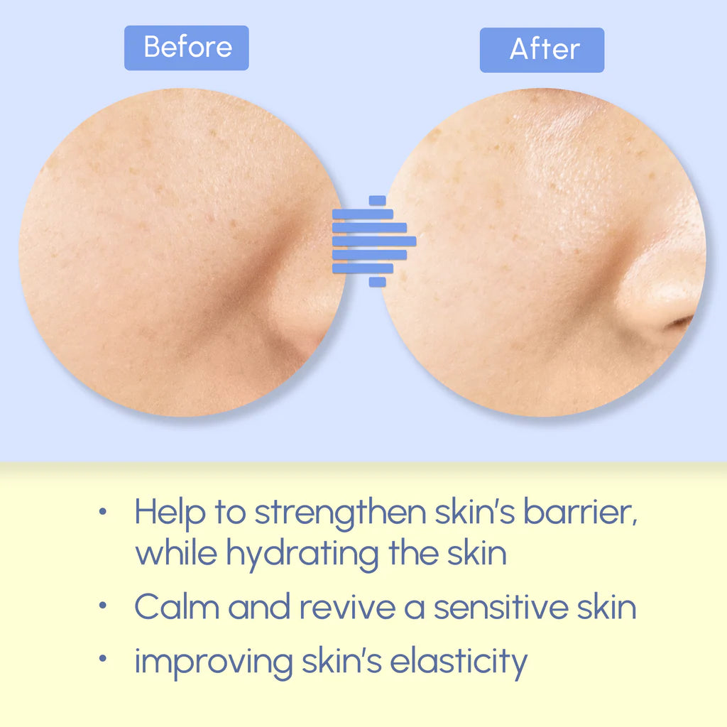 NEOGEN - Surmedic Azulene Soothing Peptide Ampoule-thekimyoung.com