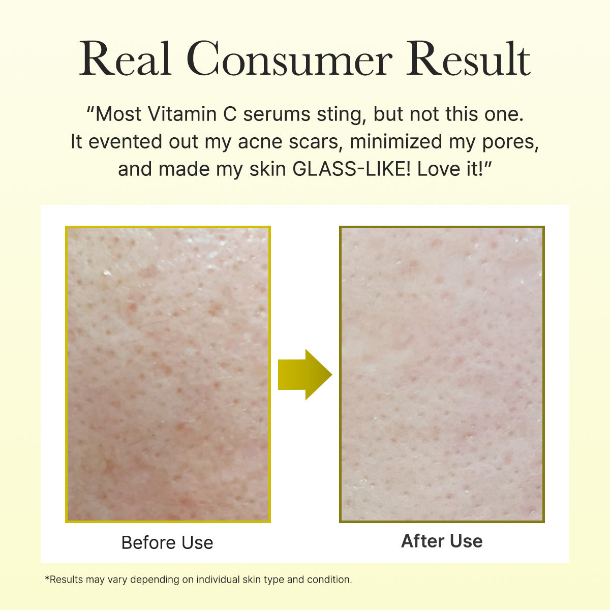 Arencia - Vitamin C Booster Shot (30ml)-thekimyoung.com