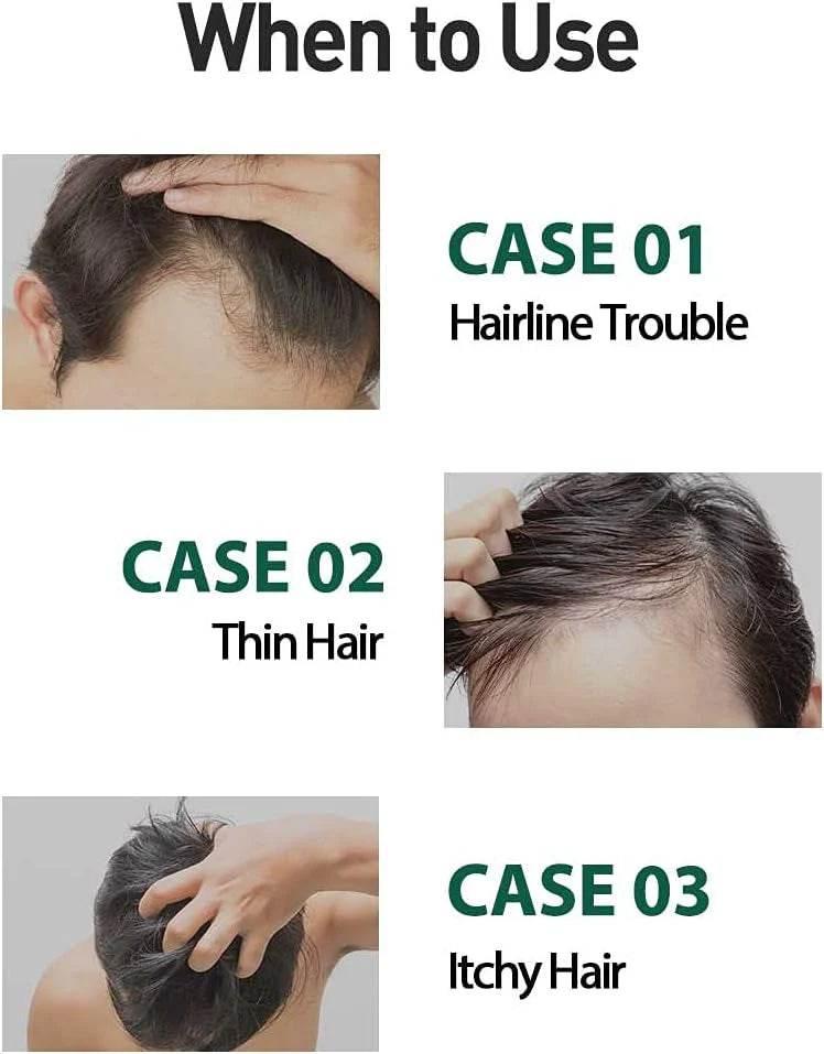 DASHU Daily Anti-Hair Loss Herb Hair Tonic 150ml-thekimyoung.com