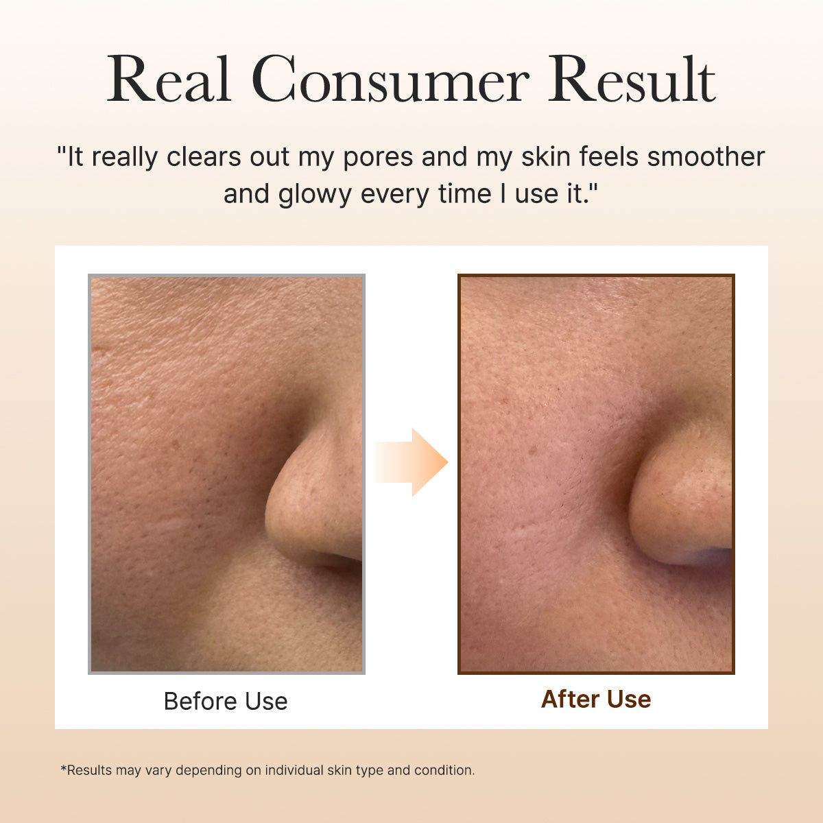Arencia - Calendula Rice Mochi Cleanser (120g)-thekimyoung.com