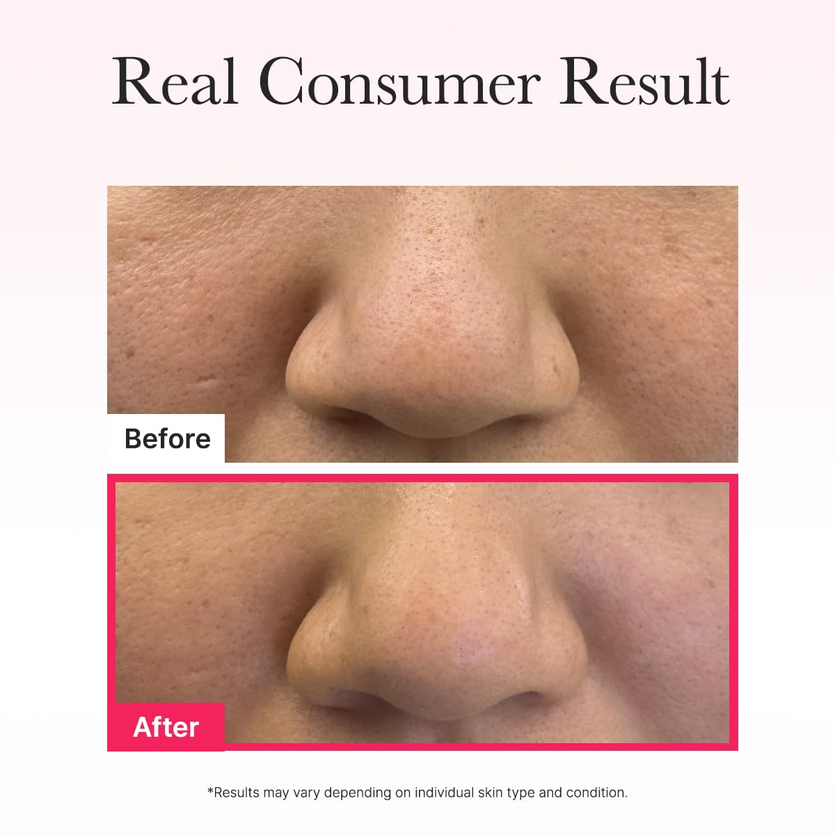 Arencia - Red Collagen Jello Mask-thekimyoung.com
