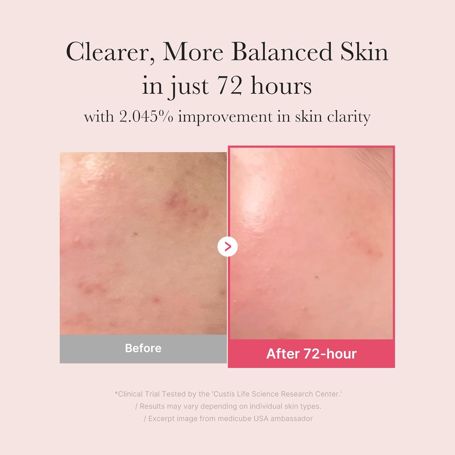 medicube TXA + Niacinamide 15% Glow Facial Serum - 30ml-thekimyoung.com