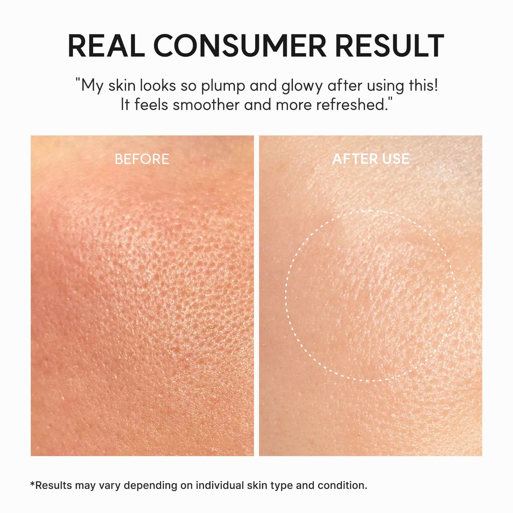 Arencia - NAD+ Time-Rewind Booster Shot (30ml)-thekimyoung.com