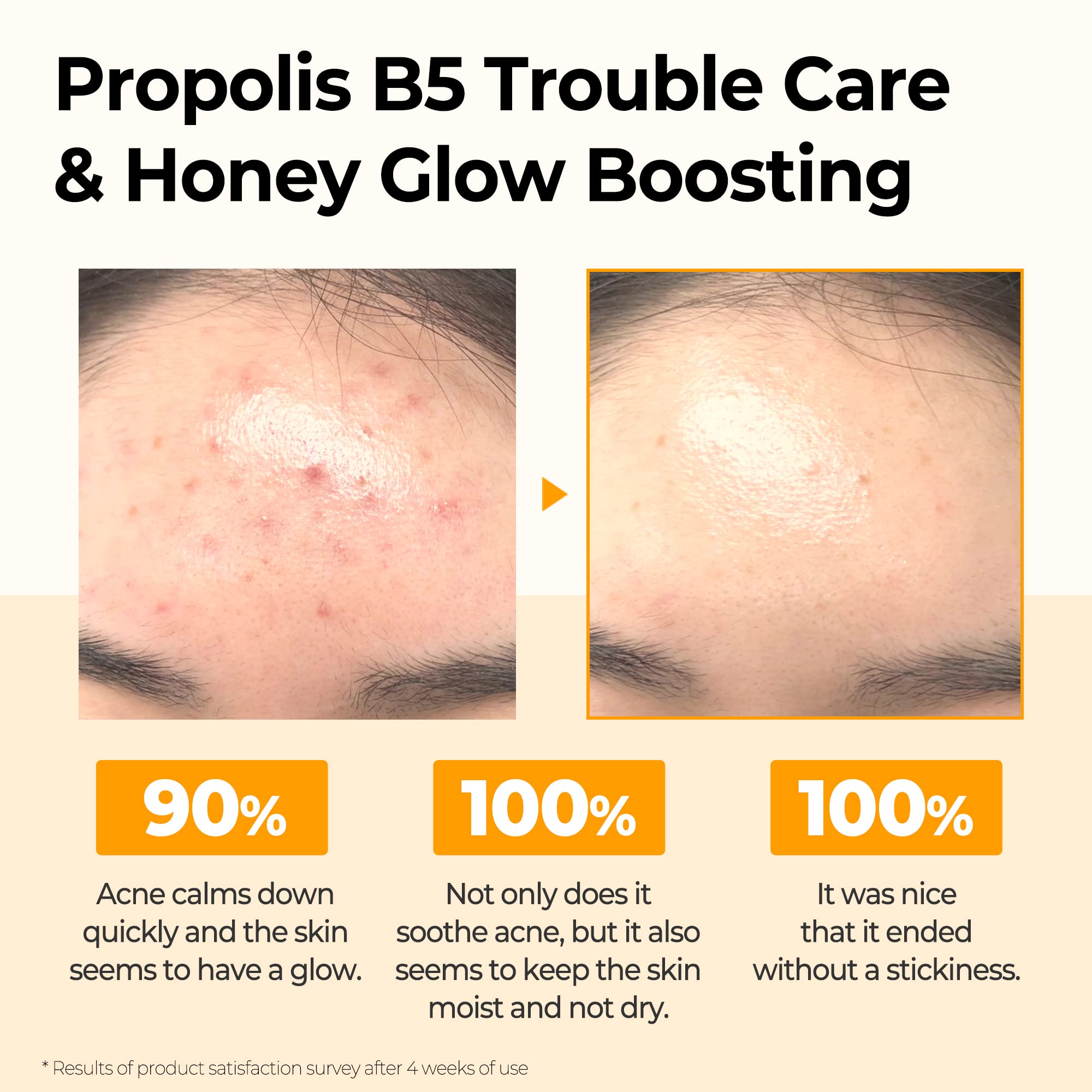 SOME BY MI - Propolis B5 Glow Barrier Calming Starter Kit-thekimyoung.com