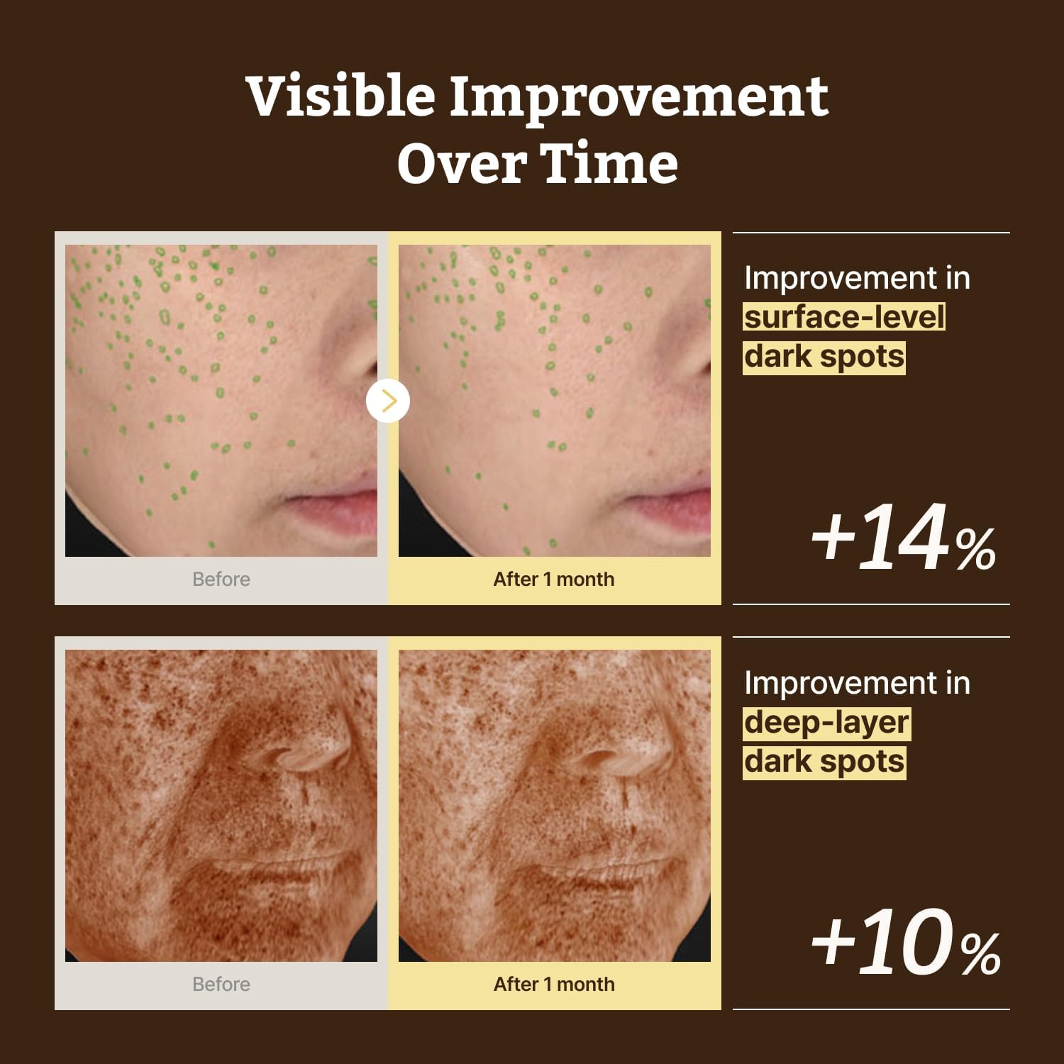 Dr.Reju-All Advanced Retino-Mela Serum (50ml) (Korean Version Bigger Size)-thekimyoung.com