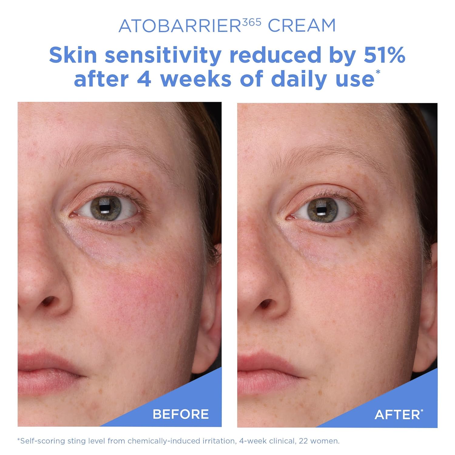 AESTURA - Atobarrier 365 Hydro Soothing Cream (New) (80ml)-thekimyoung.com