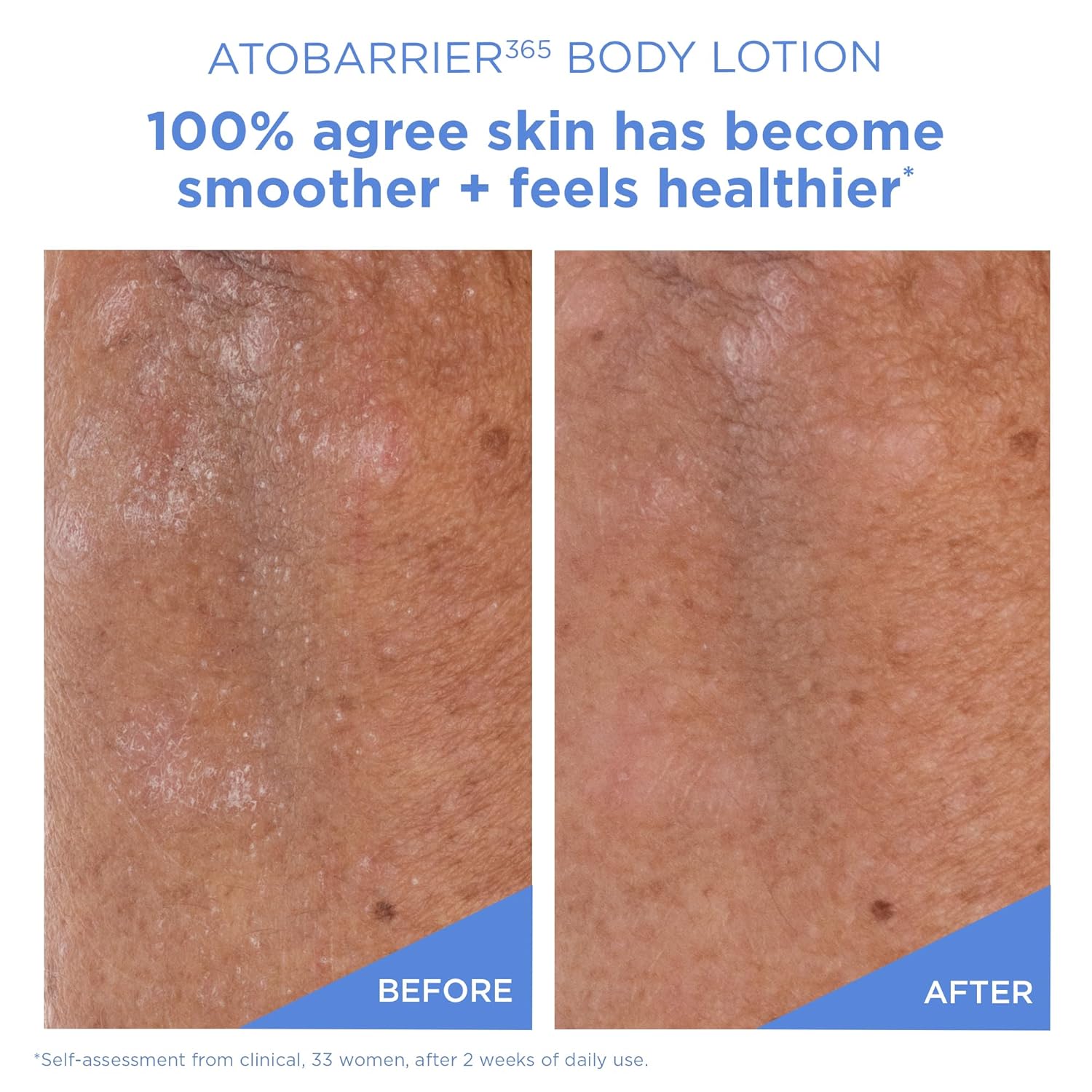 AESTURA - Atobarrier 365 Body Lotion (400ml)-thekimyoung.com