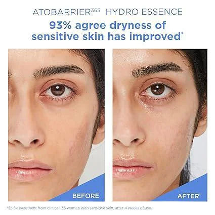AESTURA - Atobarrier 365 Hydro Essence (150ml)-thekimyoung.com