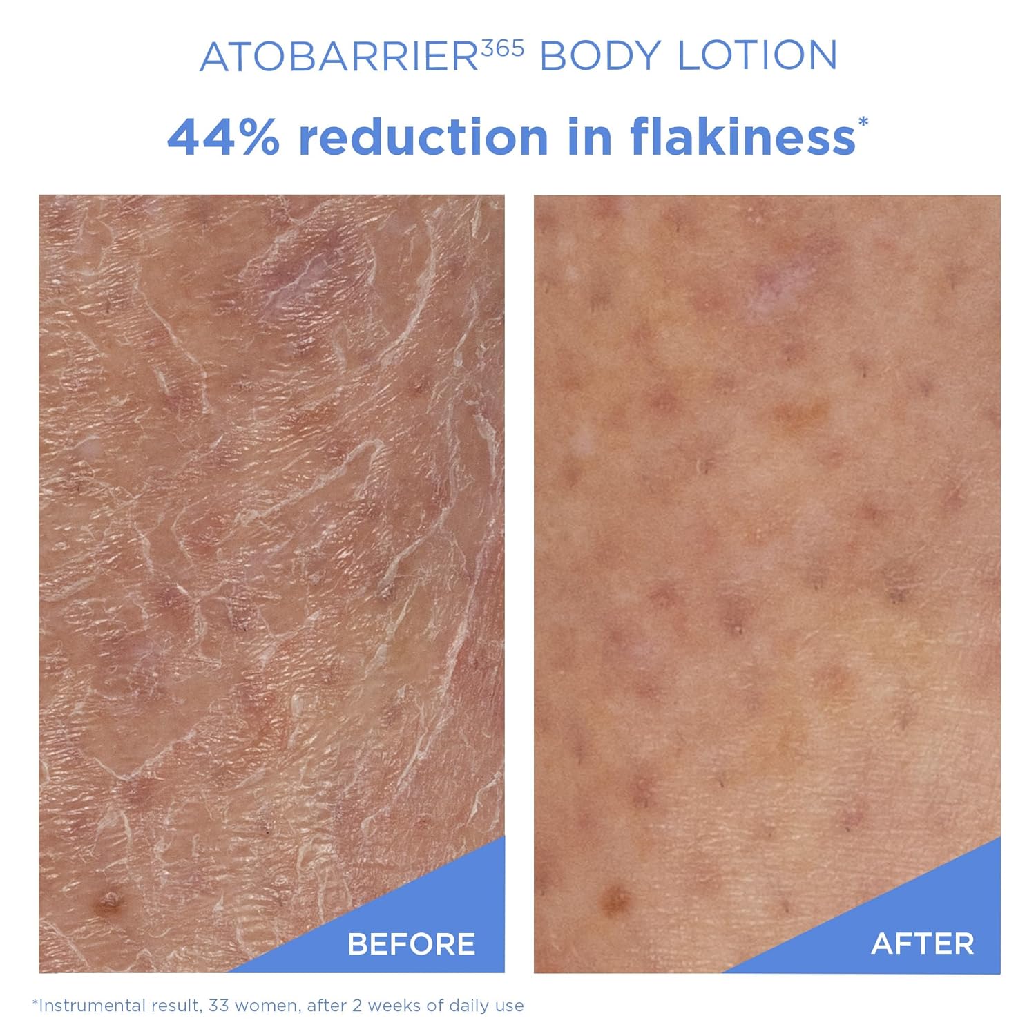 AESTURA - Atobarrier 365 Body Lotion (400ml)-thekimyoung.com