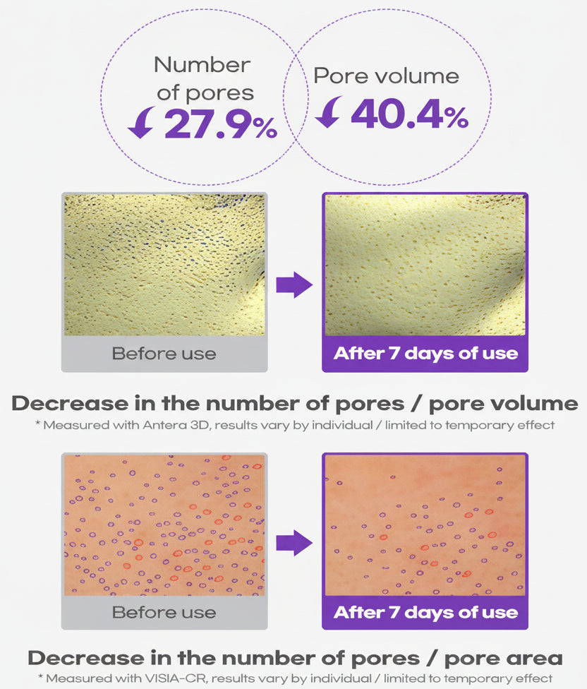 AESTURA - REGEDERM 365 Skin Tightening Capsule Serum (30ml)-thekimyoung.com