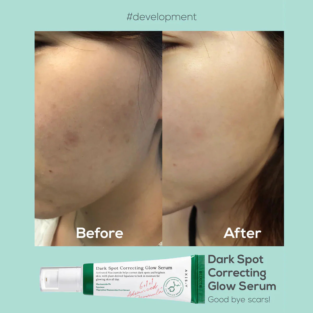 AXIS - Y - Dark Spot Correcting Glow Serum Face Serum AXIS-Y