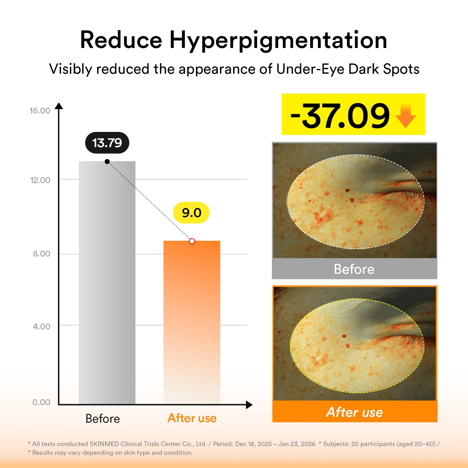 Abib - Glutathione kojic acid eye patch Vita jelly (60 Patches) [thekimyoun.com]