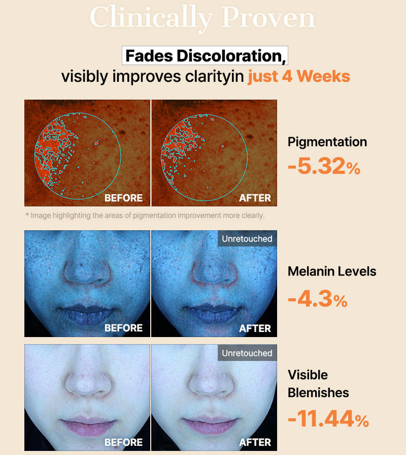 COSRX - The Alpha-Arbutin Discoloration Care Hydrogel Mask (3 Sheets)-thekimyoung.com