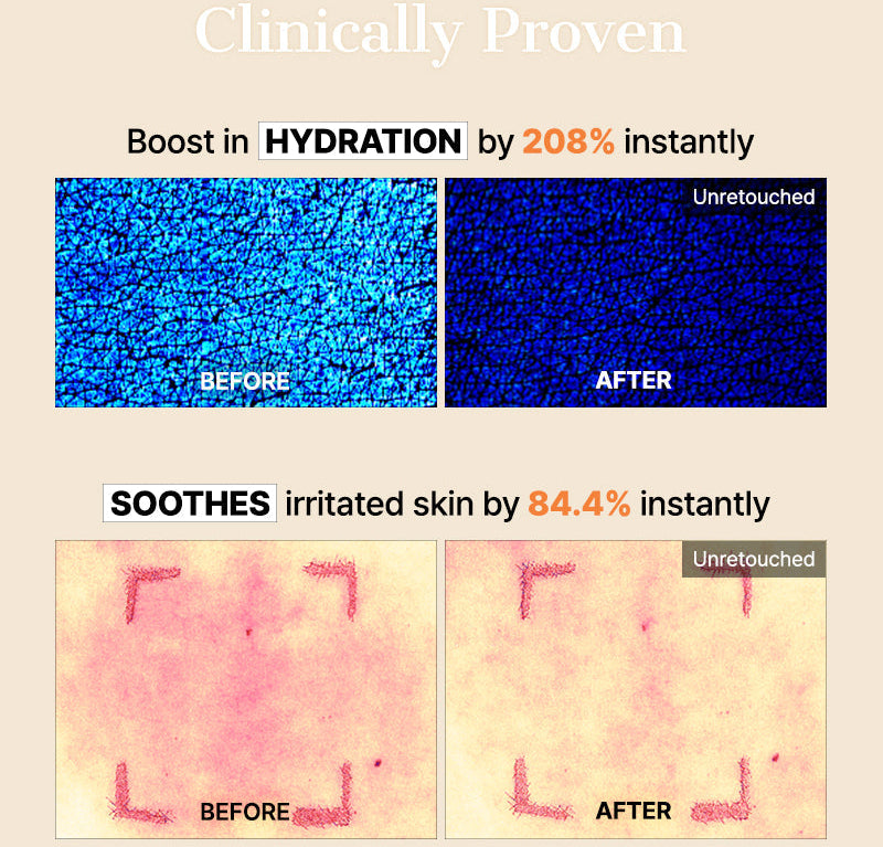 COSRX - The Alpha-Arbutin Discoloration Care Hydrogel Mask (3 Sheets)-thekimyoung.com
