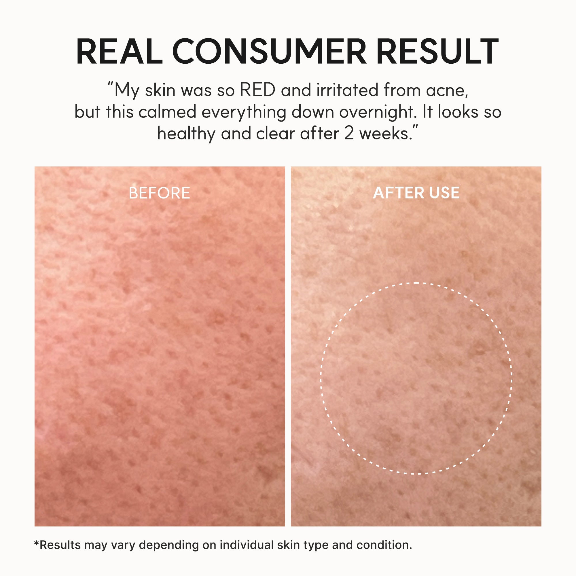 Arencia - Eraser Soothing Cream (50ml)-thekimyoung.com