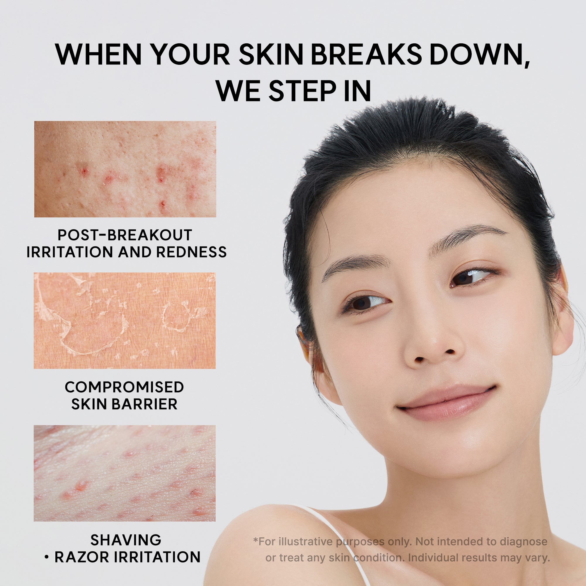 Arencia - Eraser Soothing Cream (50ml)-thekimyoung.com