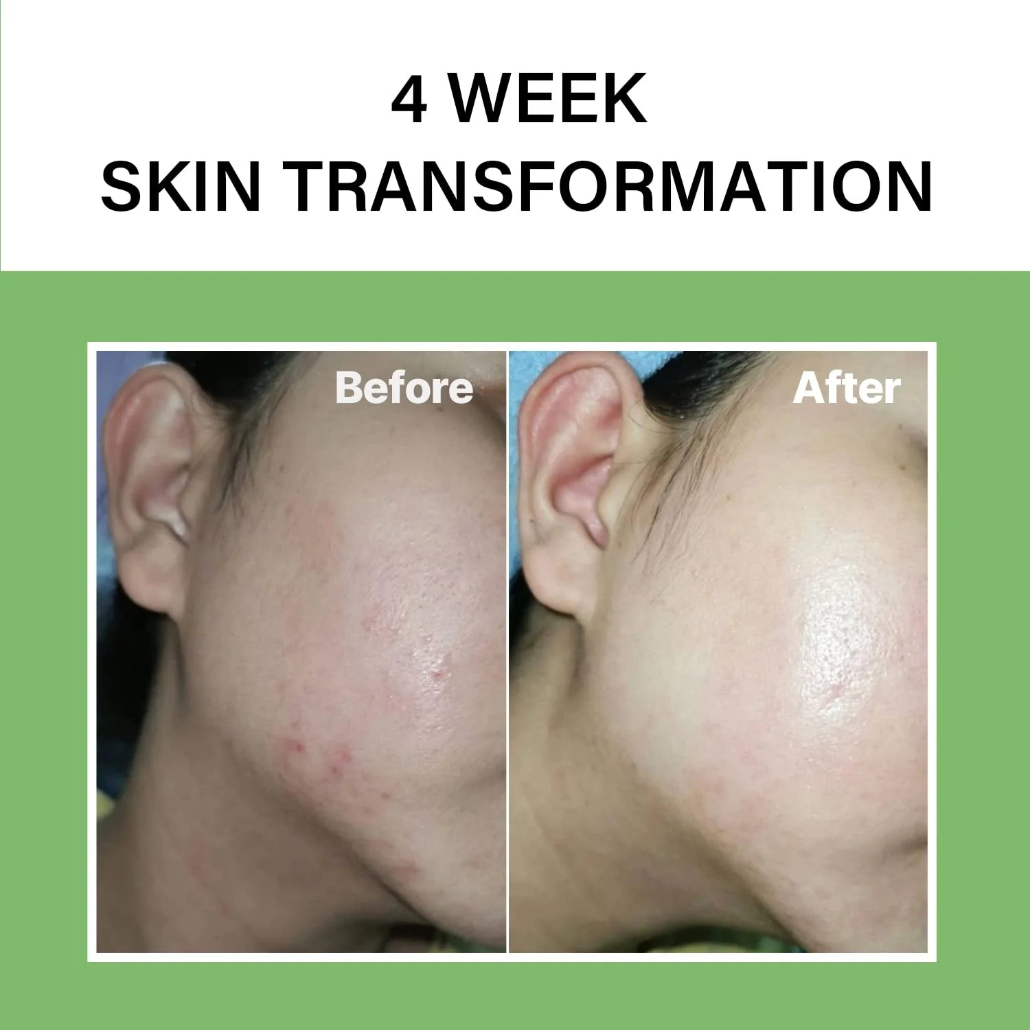 celimax The Real Noni Energy Ampoule-thekimyoung.com