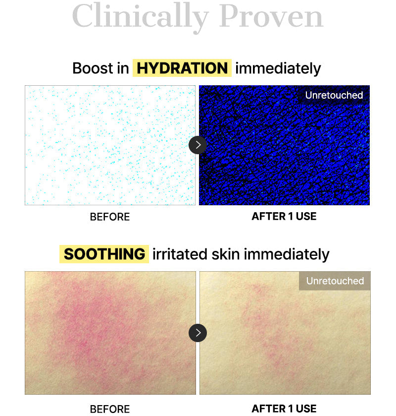 COSRX - Advanced Snail Mucin Glass Glow Hydrogel Mask (3 Sheets)-thekimyoung.com
