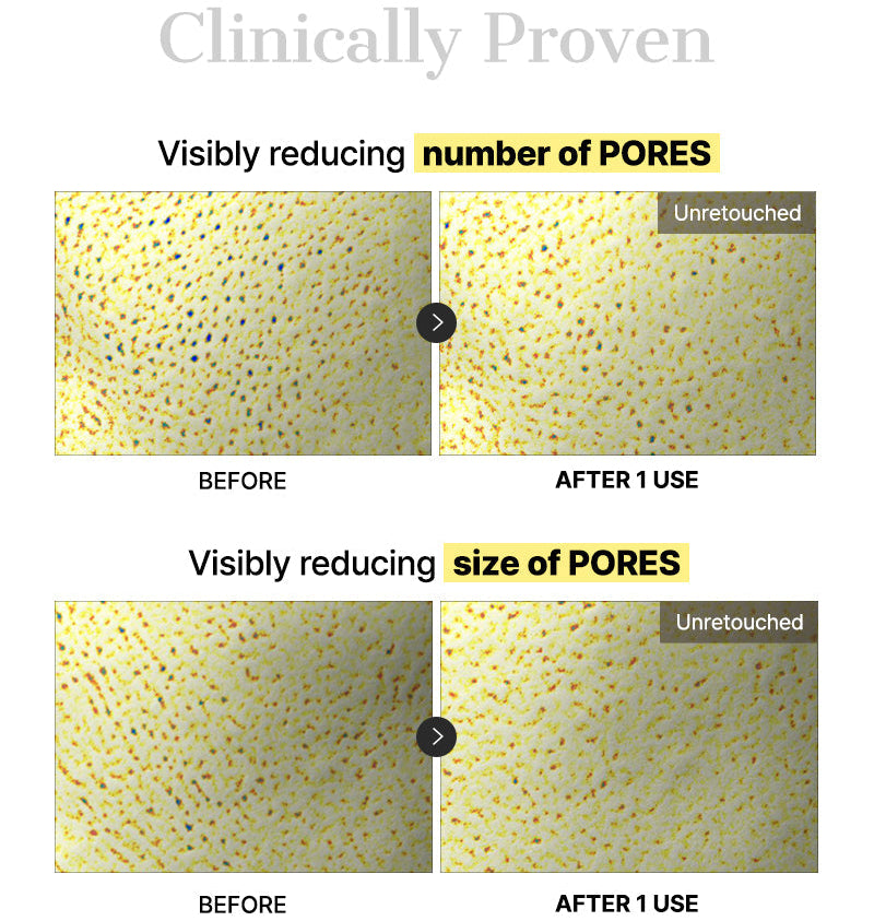 COSRX - Advanced Snail Mucin Glass Glow Hydrogel Mask (3 Sheets)-thekimyoung.com