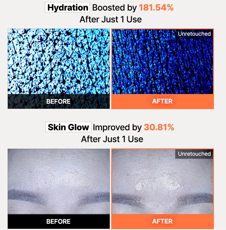 COSRX - 5 PDRN Hyaluronic Acid Vital Hydrating Hydrogel Mask (1 Pack 3ea)-thekimyoung.com