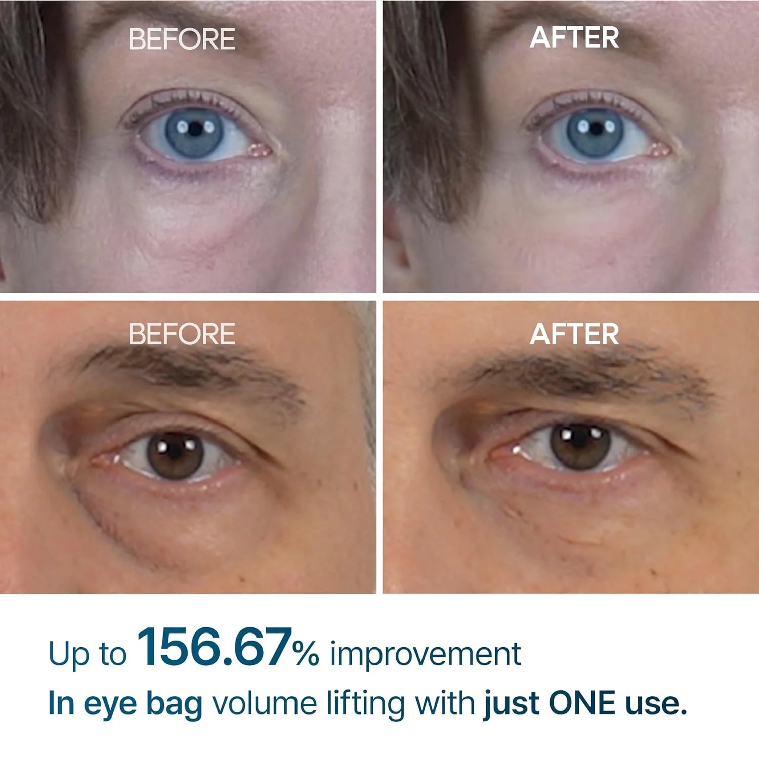 Dr.Melaxin EYEPHALT™ Eyecream for Eyebags 10ml-thekimyoung.com