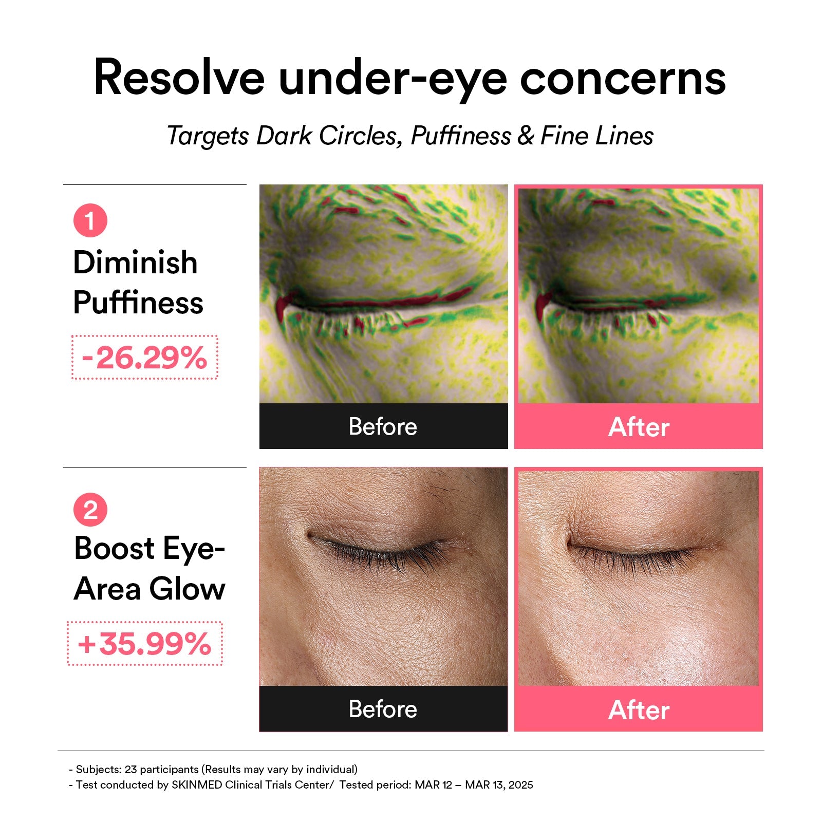 Abib - PDRN retinal eye patch Glow jelly (60 Patches)-thekimyoung.com
