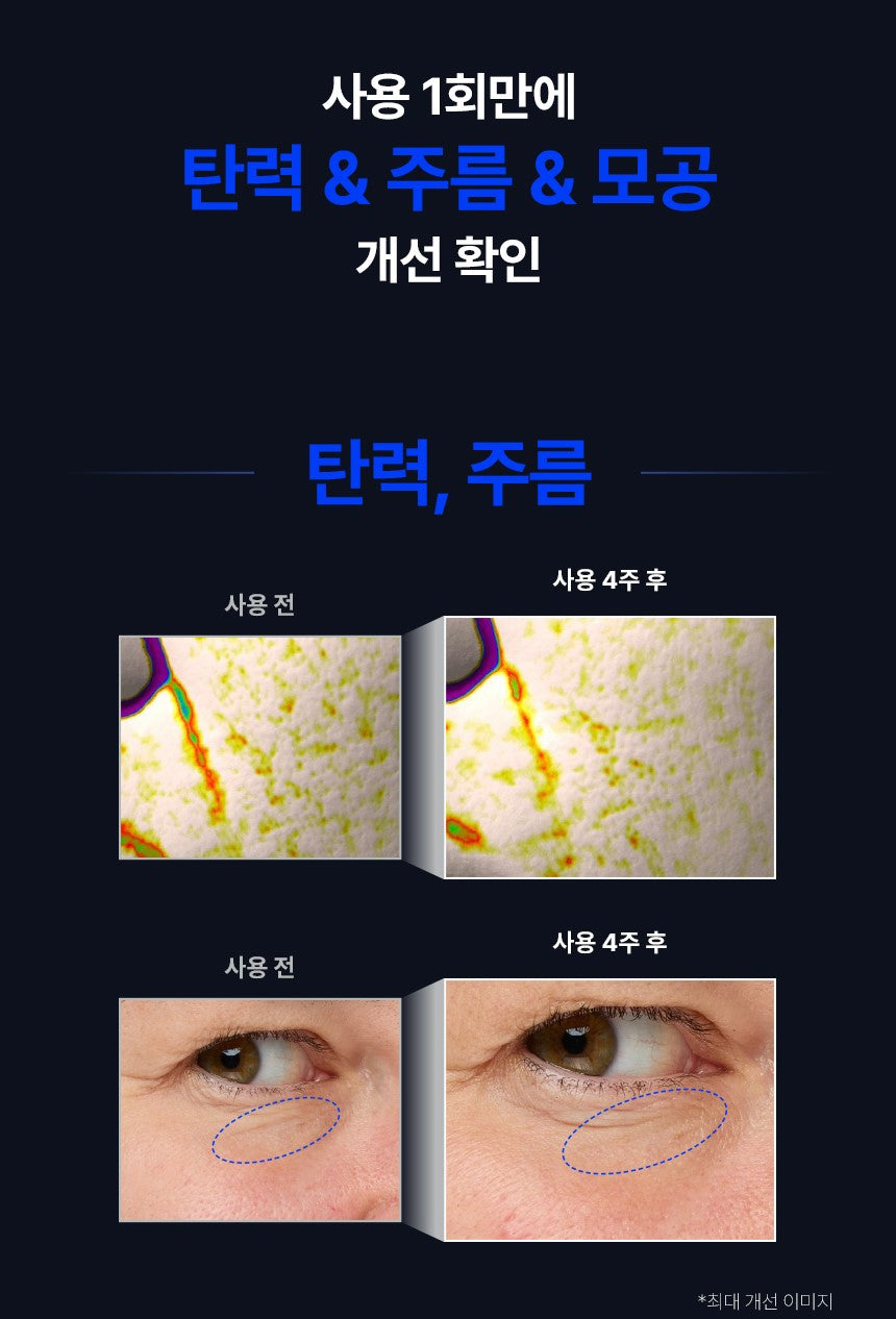 (NEW) IOPE Retinol Reti-Jection Serum 2% 50ml Face Serum IOPE