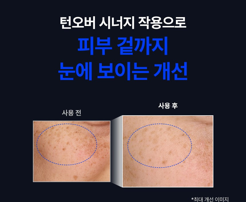 (NEW) IOPE Retinol Reti-Jection Serum 2% 50ml Face Serum IOPE