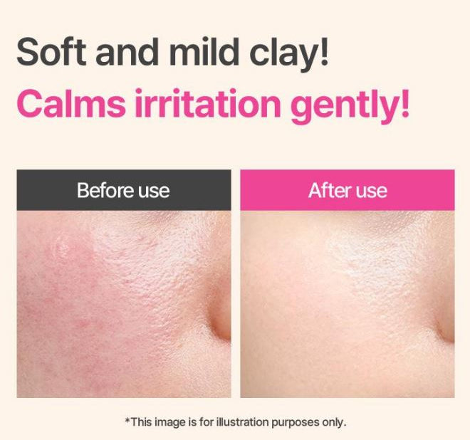 I'm From - Beat Purifying Mask-thekimyoung.com