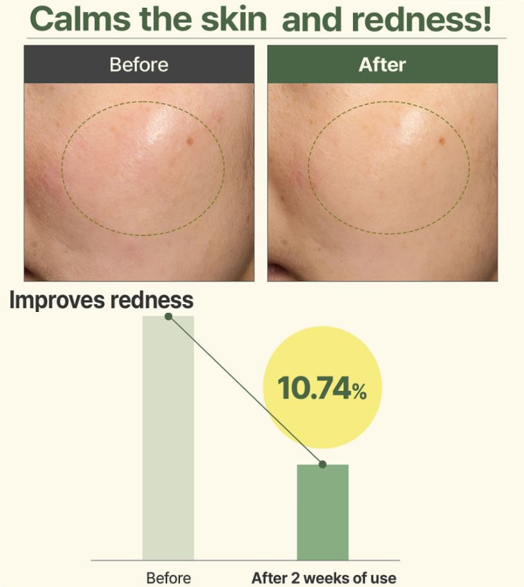 I'm From - Mugwort Serum (30ml)-thekimyoung.com