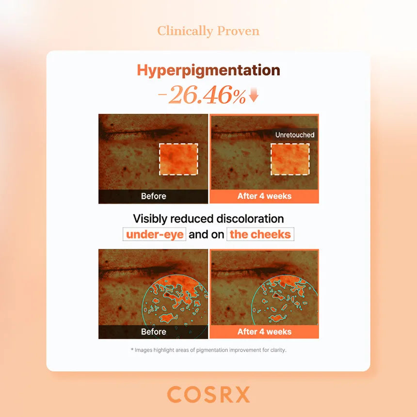COSRX - 5 PDRN Collagen Vitalizing Hydrogel Eye Patch-thekimyoung.com