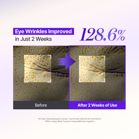 MILDLAB - 5 EGF Retinal Liftinal Turnover Ampoule 30ml-thekimyoung.com