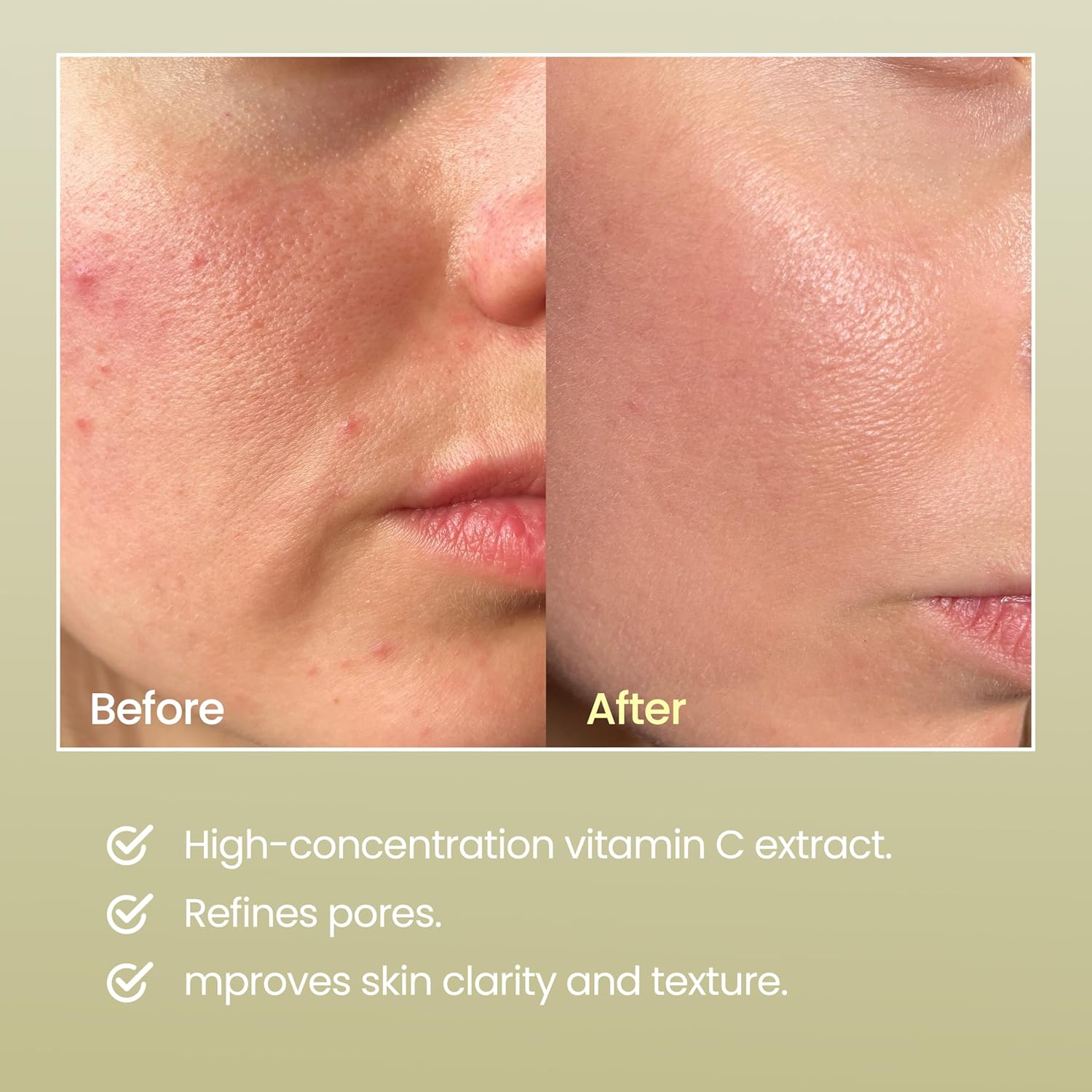 NEOGEN - Real Vitamin C Serum 30ml-thekimyoung.com