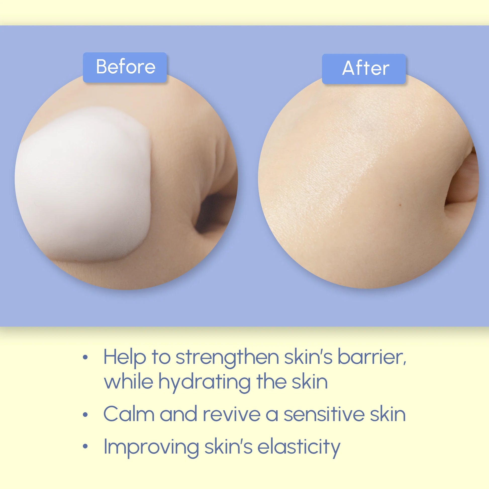 NEOGEN - Surmedic Azulene Soothing Mousse Toner (110ml)-thekimyoung.com