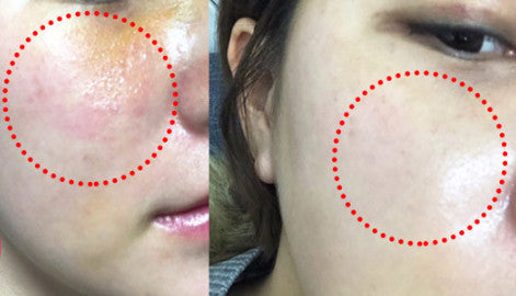 NEOGEN - Surmedic Azulene Soothing Peptide Ampoule-thekimyoung.com
