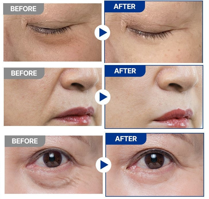 NEOGEN - Agecure One Minute Wrinkle Lift 3ml-thekimyoung.com