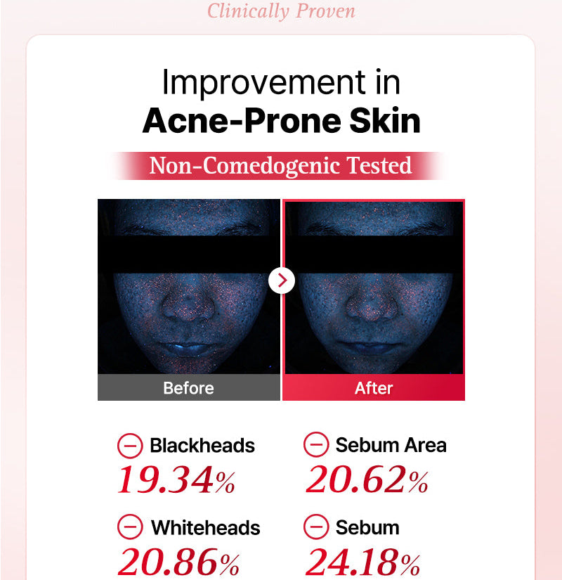 COSRX - One Step Original Blemish Pore Clear Pad (100 Pads)-thekimyoung.com