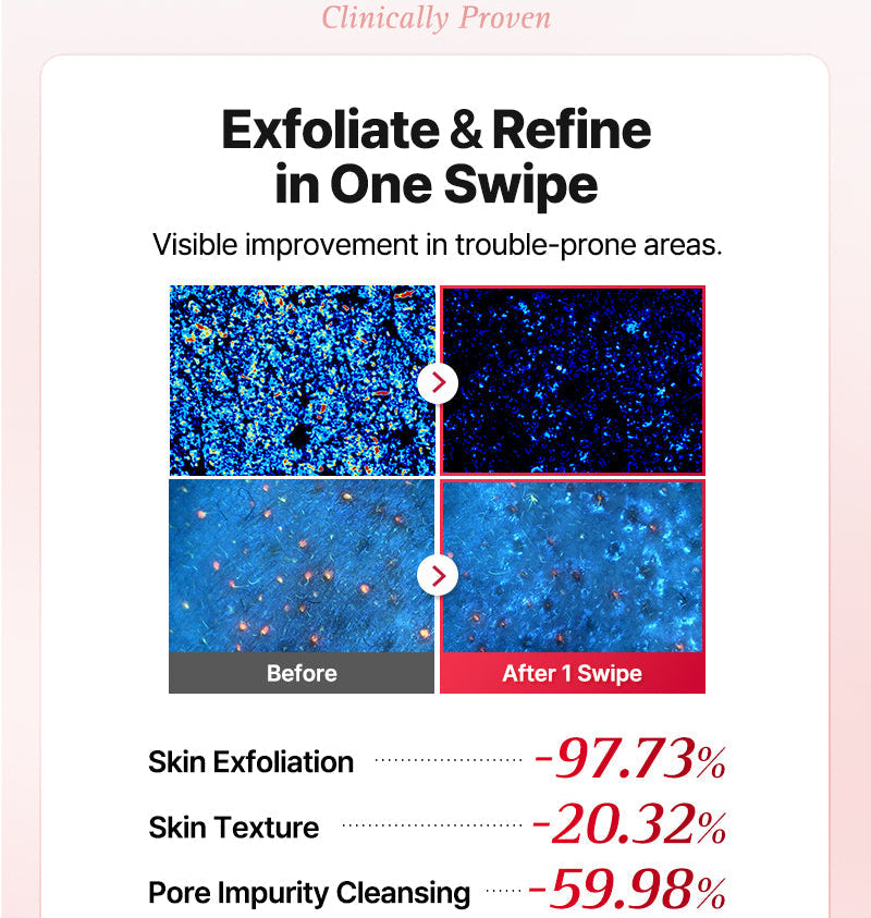 COSRX - One Step Original Blemish Pore Clear Pad (100 Pads)-thekimyoung.com