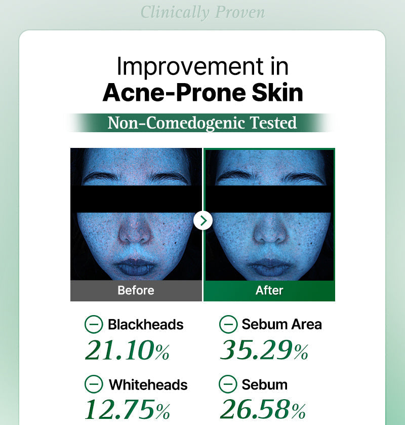 One Step Original Clear Skin Calming Pad (100 Pads)-thekimyoung.com