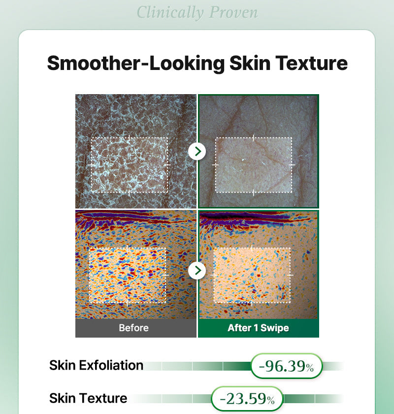 One Step Original Clear Skin Calming Pad (100 Pads)-thekimyoung.com