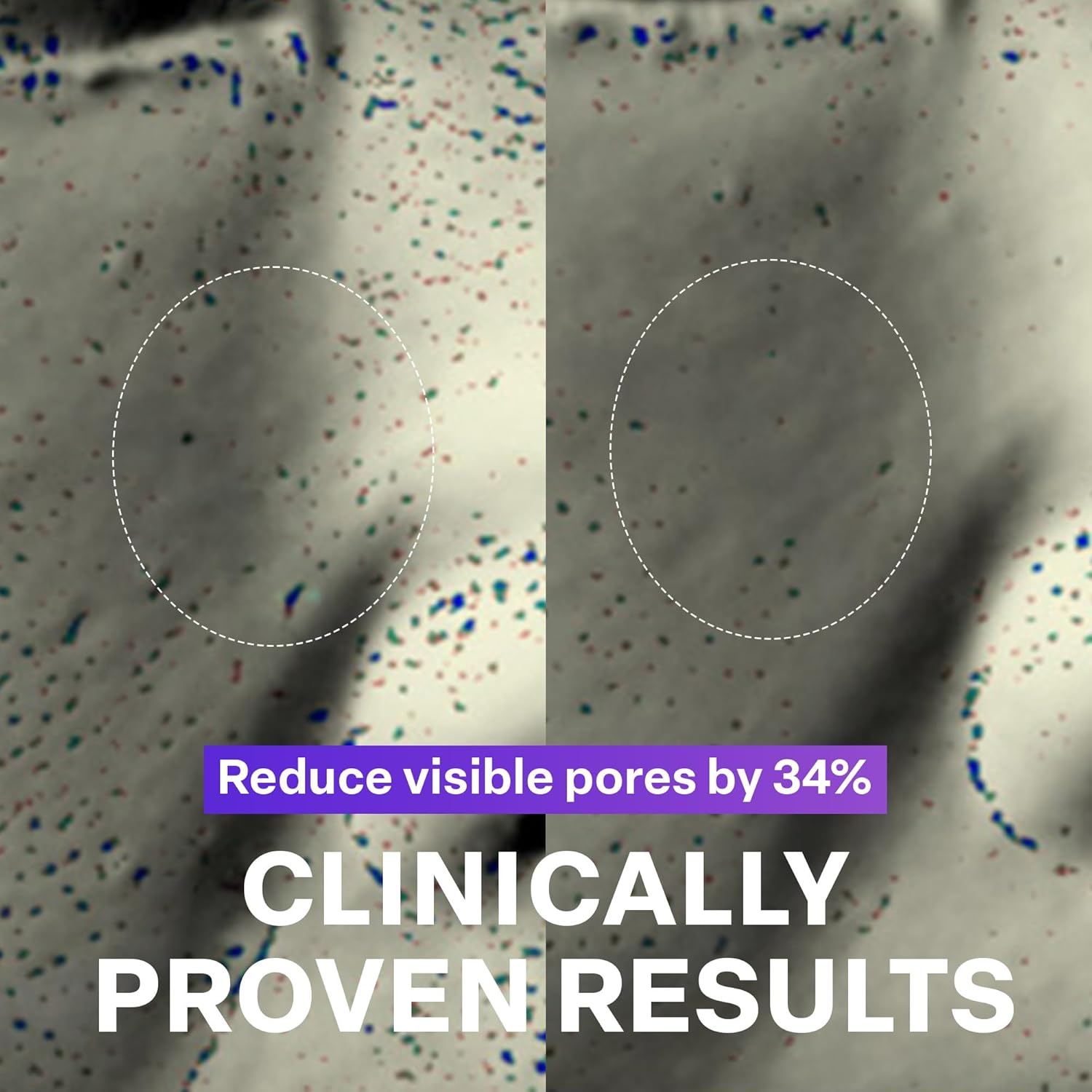PURCELL PIXCELL BIOM™ Glow Barrier Serum (50ml)-thekimyoung.com
