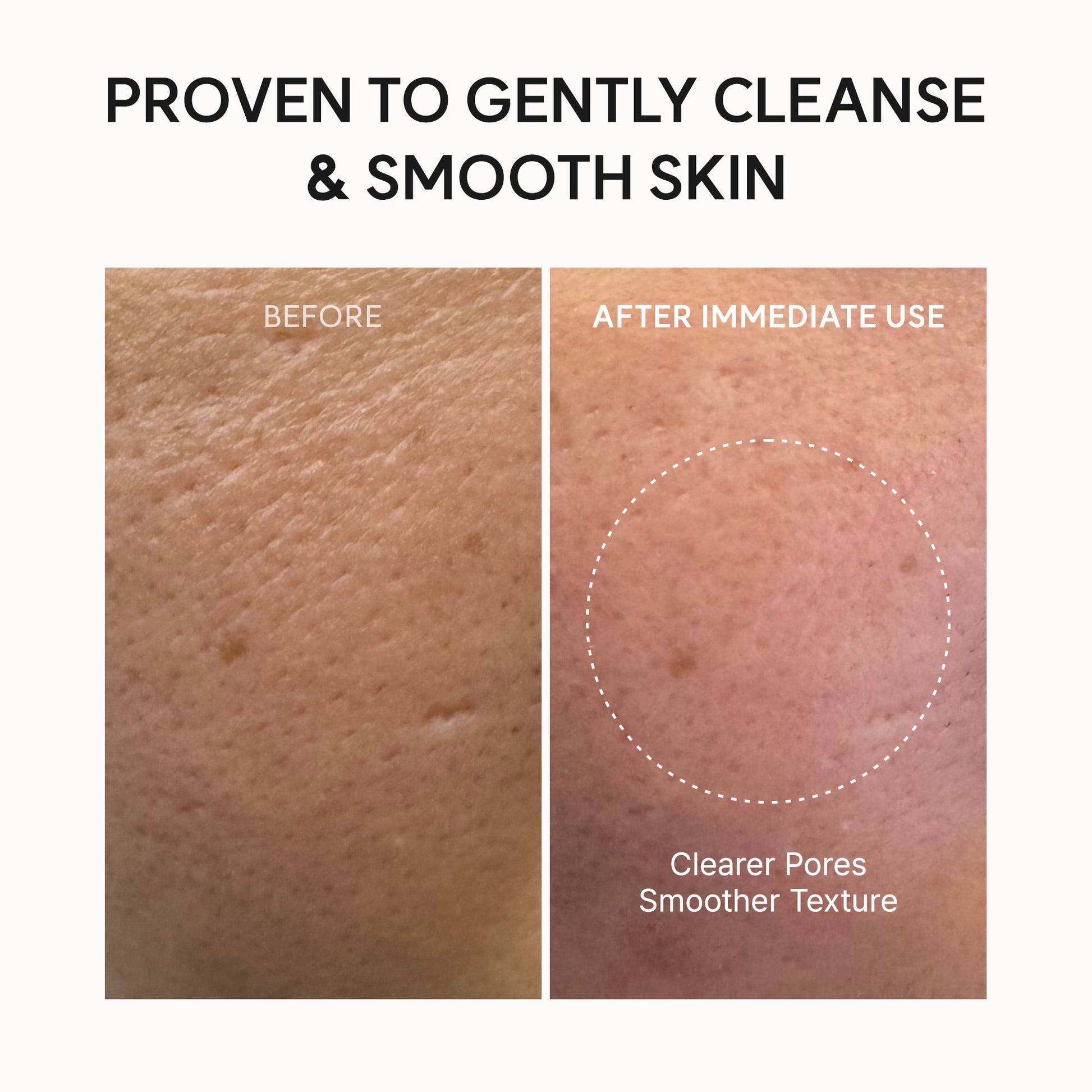 Arencia - Fresh Rosehip Mochi Cleanser (120g)-thekimyoung.com