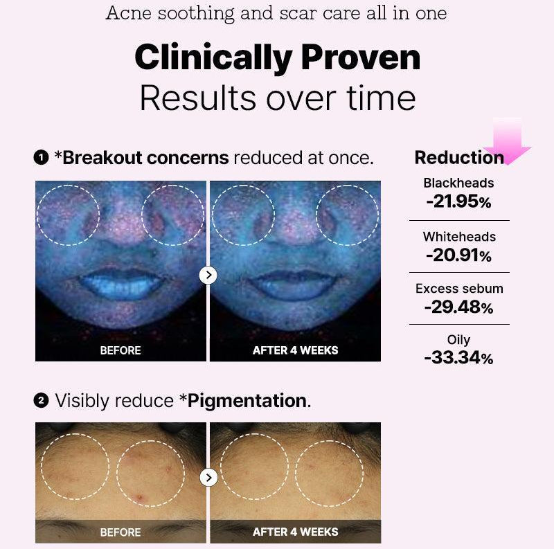 COSRX - The 6 Peptide Skin Booster Serum (150ml)-thekimyoung.com