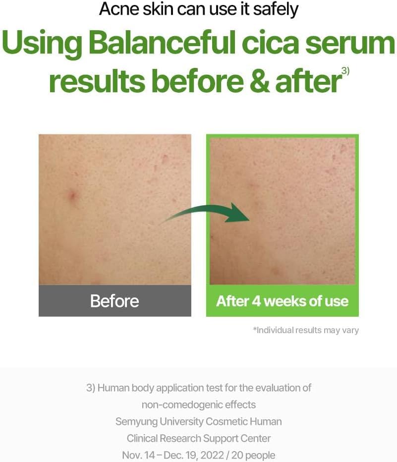 Torriden - Balanceful Cica Calming Serum (50ml)-thekimyoung.com