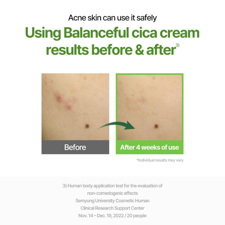 Torriden - Balanceful Cica Soothing Cream (80ml)-thekimyoung.com